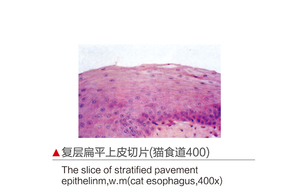 D130005.復(fù)層扁平上皮切片